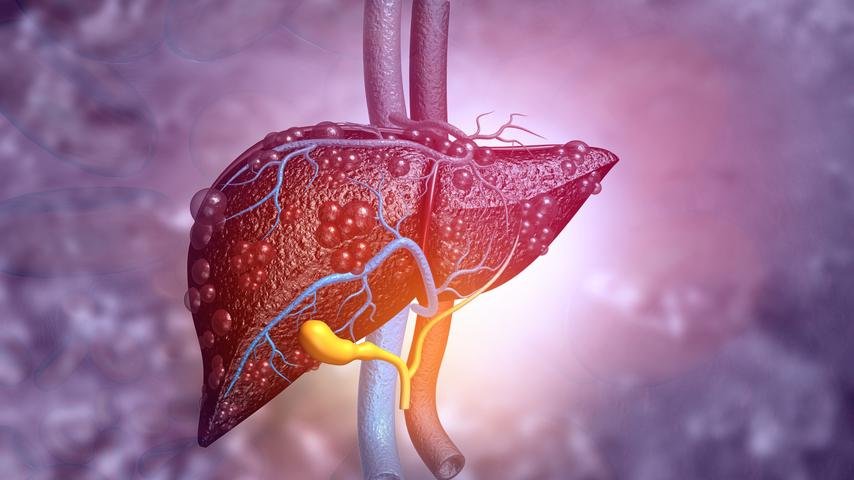Liver Cancer